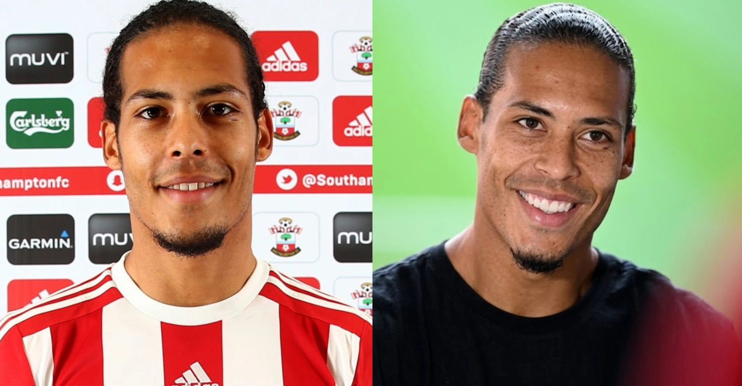 Virgil van Dijk before and after